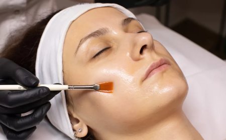 Chemical Peels Cost Guide for Safe and Visible Skin Repair