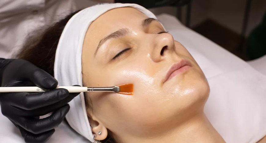 Chemical Peels Cost Results – What You Need to Know Now