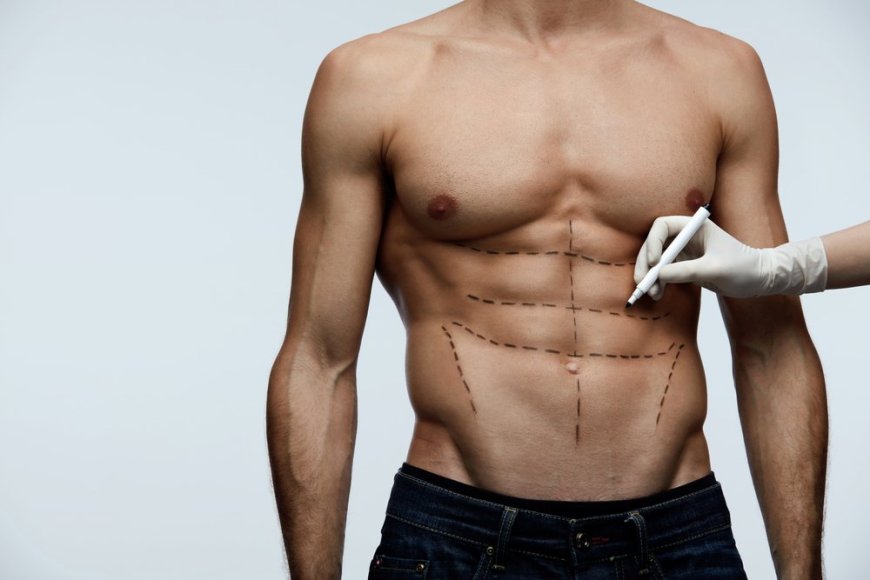 Vaser 4D Liposuction Benefits for Stubborn Fat and Shaping