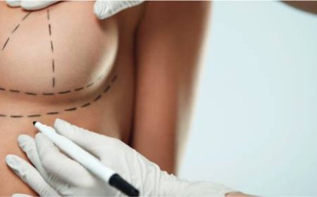 Breast Lift Dubai: Reclaim Firmness and Shape with Expert Surgical Techniques