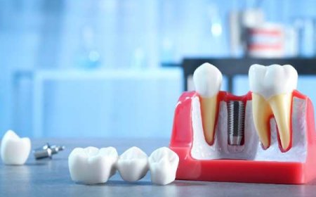 Transforming Smiles with Local Expertise in Croydon