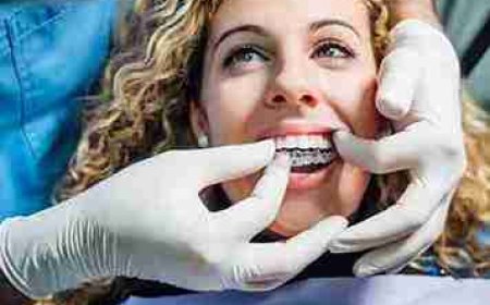 Sun, Sand, and Aligners? Important Things to Consider