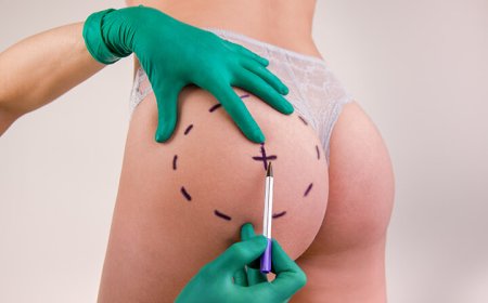 Enhance Your Silhouette Easily with Butt and Body Fillers