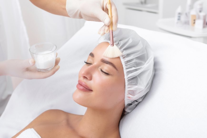 Is Chemical Peels Cost Justified by the Clear Skin Results?