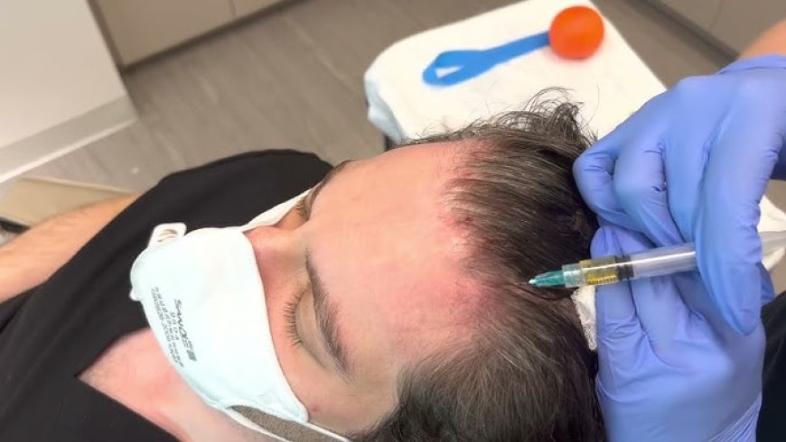 What You’re Really Paying for in PRP Treatment Cost Explained