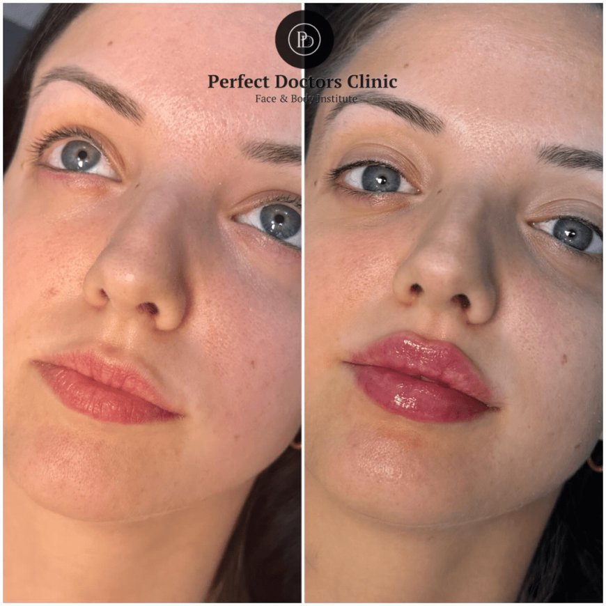 Can You Get Juvederm While Pregnant? Advice from the Best Aesthetic Clinics in Dubai