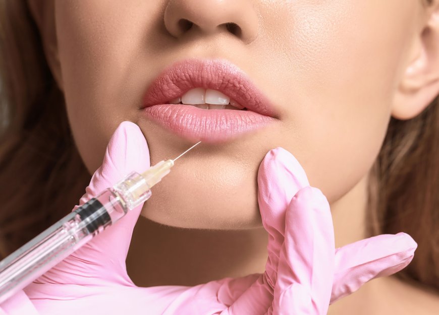 Best Lip Fillers Injections for a Defined, Kissable Lip Shape