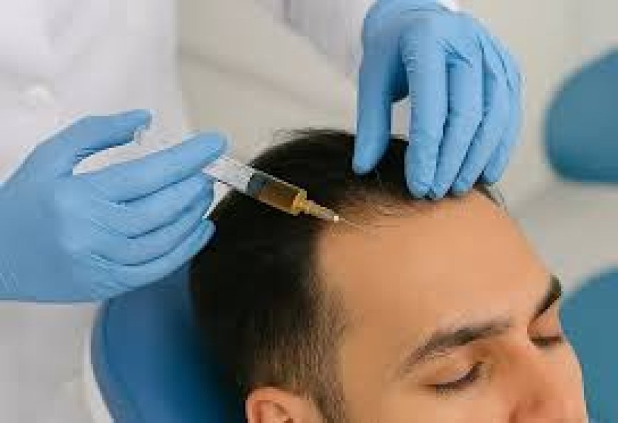 Is the Best PRP Hair Treatment Your Answer to Hair Fall Worries?