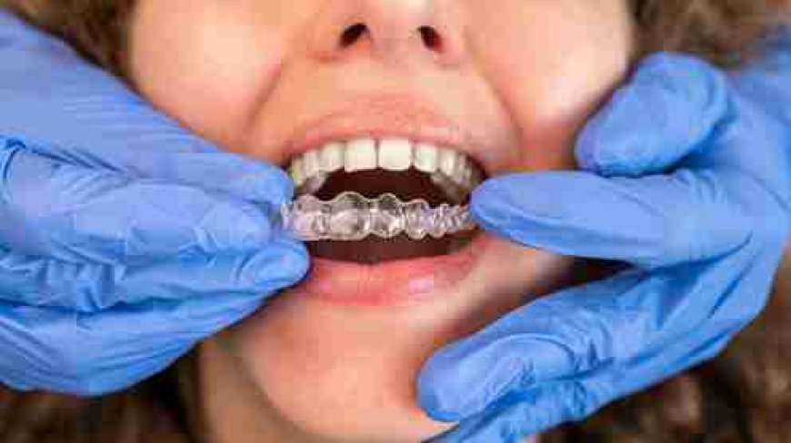 Image Source - Private Dentist Earsfield