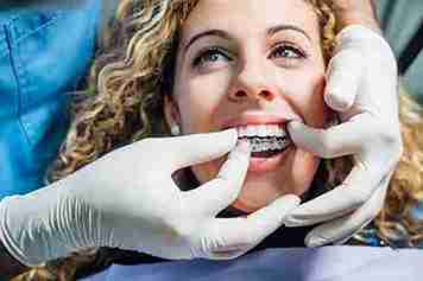 Sun, Sand, and Aligners? Important Things to Consider