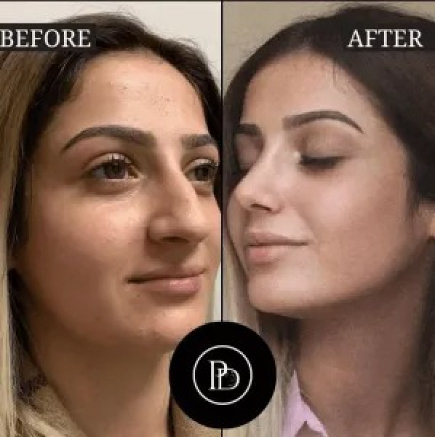 Best Doctors in Dubai for Natural, Beautiful Results