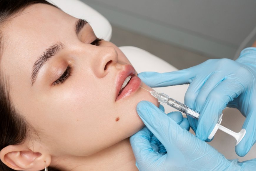 Reveal a Younger Look With the Best Lip Fillers Injections